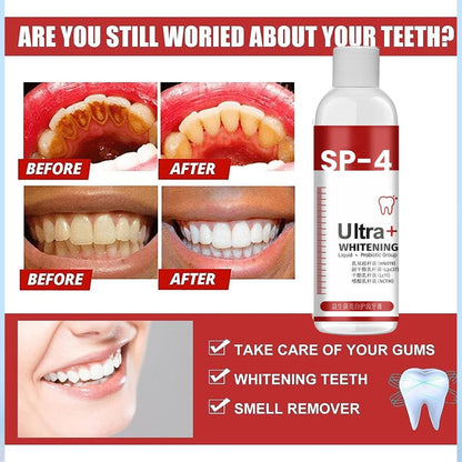 SP-4 Ultra+ Whitening Teeth (Pack of 1)SP-4 Ultra+ Whitening Teeth (Pack of 1)